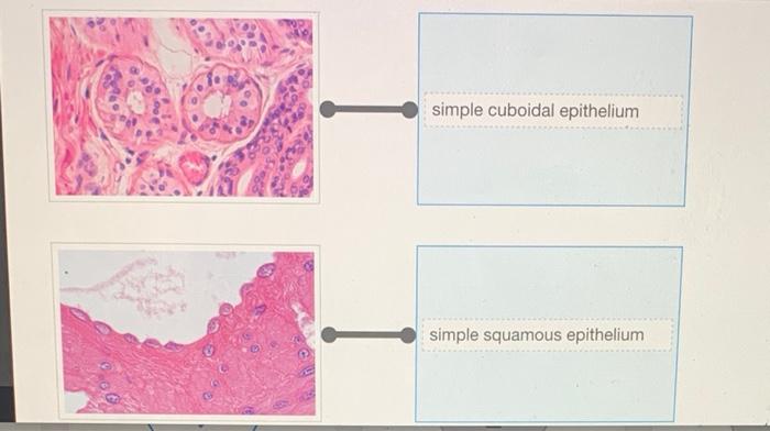 Rearrange the epithelium types to correspond to the correct image.