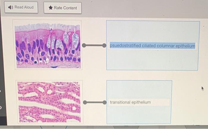 Rearrange the epithelium types to correspond to the correct image.