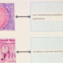 Epithelial cells tissue diagram location epithelium simple meaning illustration human squamous vector cell body anatomy medical anatomical illustrations biology smooth