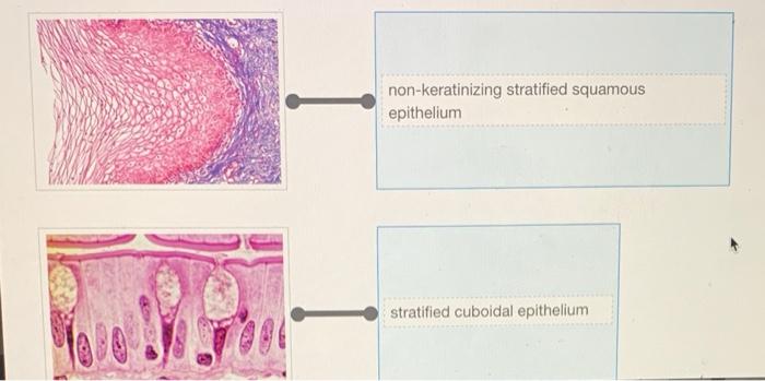 Epithelial cells tissue diagram location epithelium simple meaning illustration human squamous vector cell body anatomy medical anatomical illustrations biology smooth